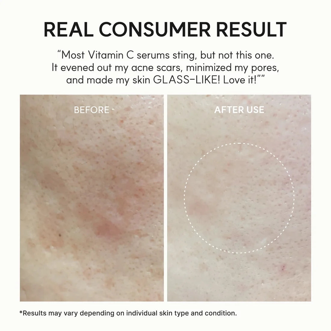 Arencia Vitamin C Booster Shot 30ml | Brightening & Glow Care