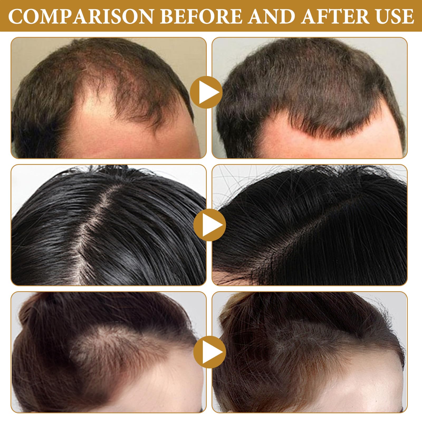 Biotin Hair Spray Repair Hair (imported from germany)
