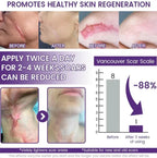 ReGenScar Stem Cell Repair Gel (Visible Scar Improvement in 7 Days) (Buy 1 Get 1 Free)