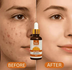 Relax Vitamin C Serum