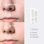 Dr Althea 345 Relief Cream 50ml - Made in Korea - Buy 1 Get 1 Free